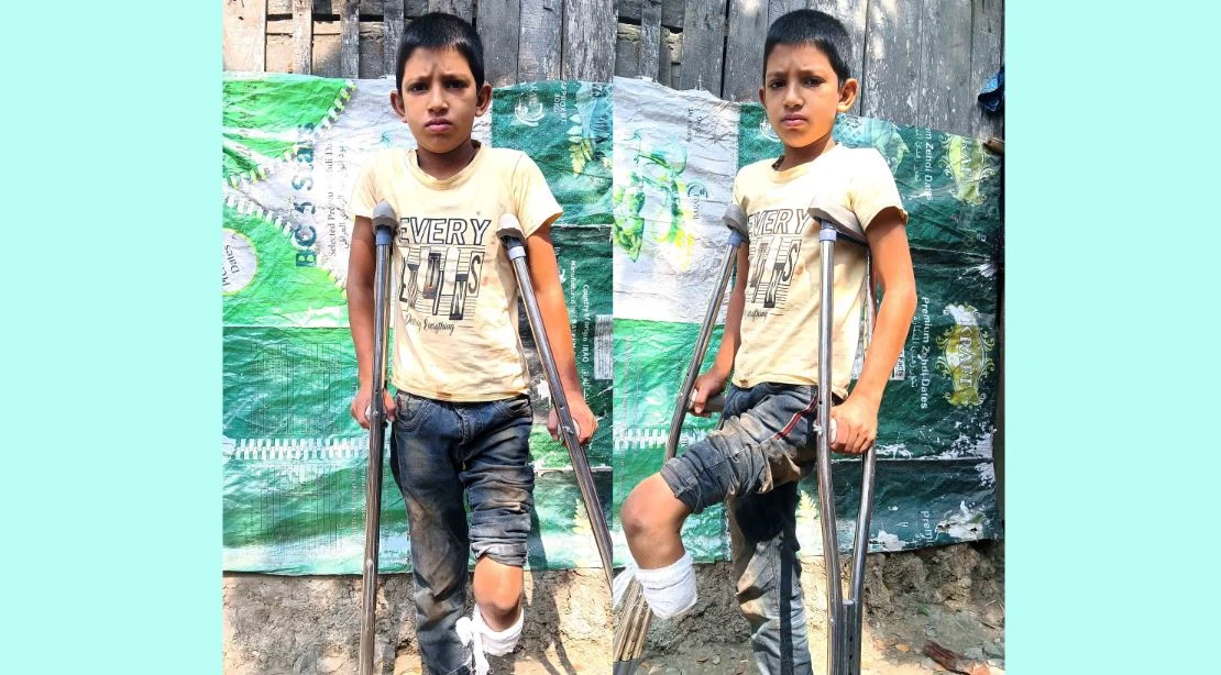 ট্রেনে পা হারানো কেশবপুরের শাকিলের চিকিৎসা অর্থাভাবে বন্ধ হতে চলেছে