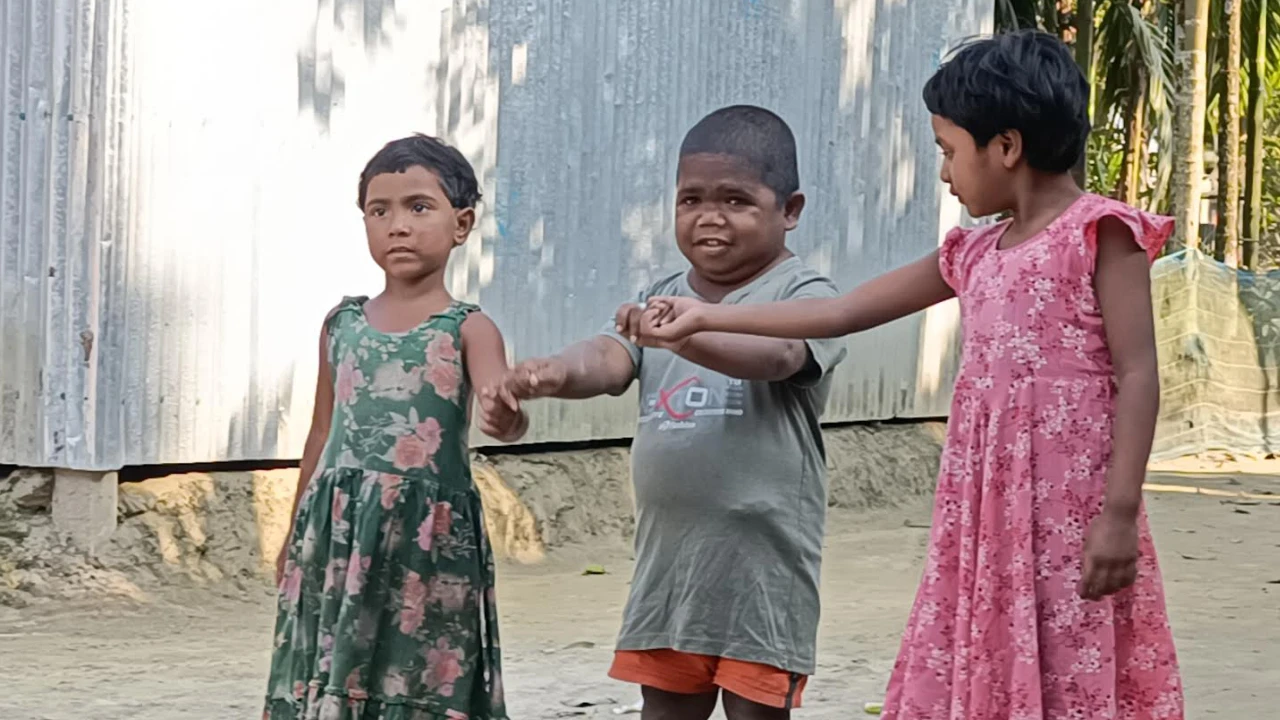 ৮ বছরের শিশুর শরীরে আটকে আছেন ৩২ বছরের ছমির